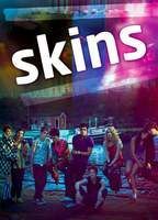Skins