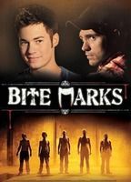 Bite Marks