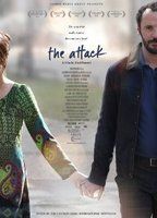 The Attack